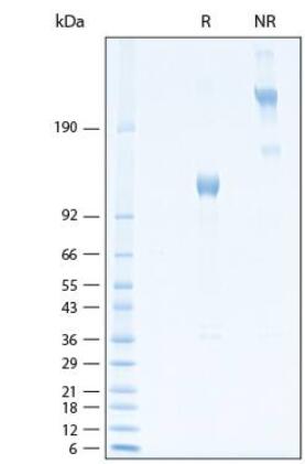 2 μg/lane of Recombinant Human Osteoactivin/GPNMB Fc Chimera Avi-tag Protein was resolved with SDS-PAGE under reducing (R) and non-reducing (NR) conditions and visualized by Coomassie Blue staining, showing bands at 110-126 kDa and 220-250 kDa, respectively.